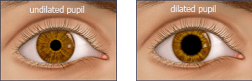 eye-dilation